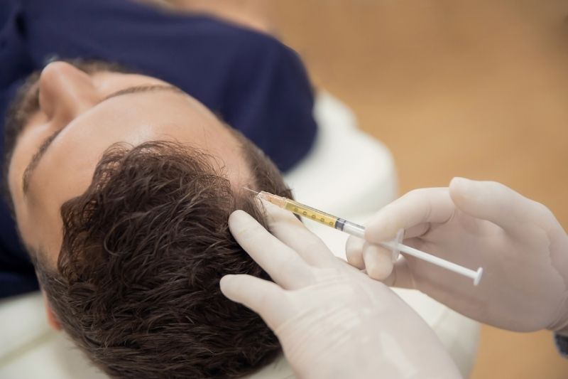 What is PRP Hair Treatment?