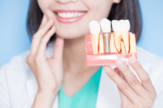 dental implant and crown